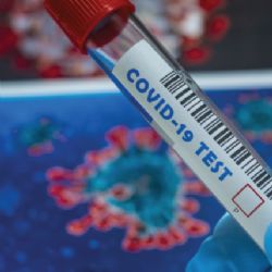 Osmnáct pražských městských částí projevilo zájem o testování ve školách